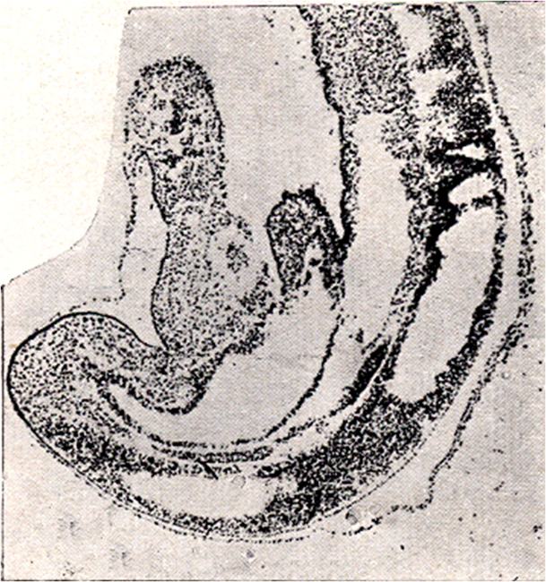medial view