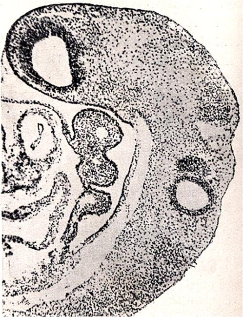 medial view